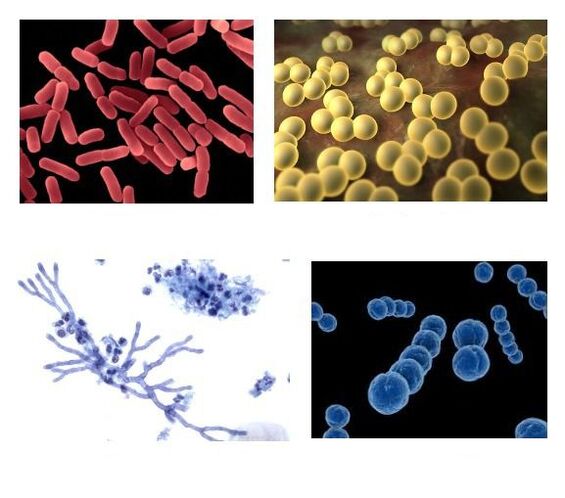 patóxenos de descarga patolóxica